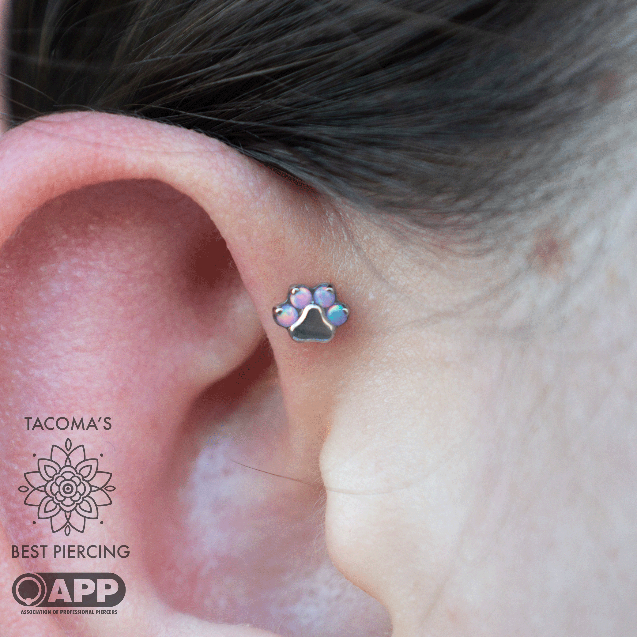 Appointment: Forward Helix (13-17 years old)